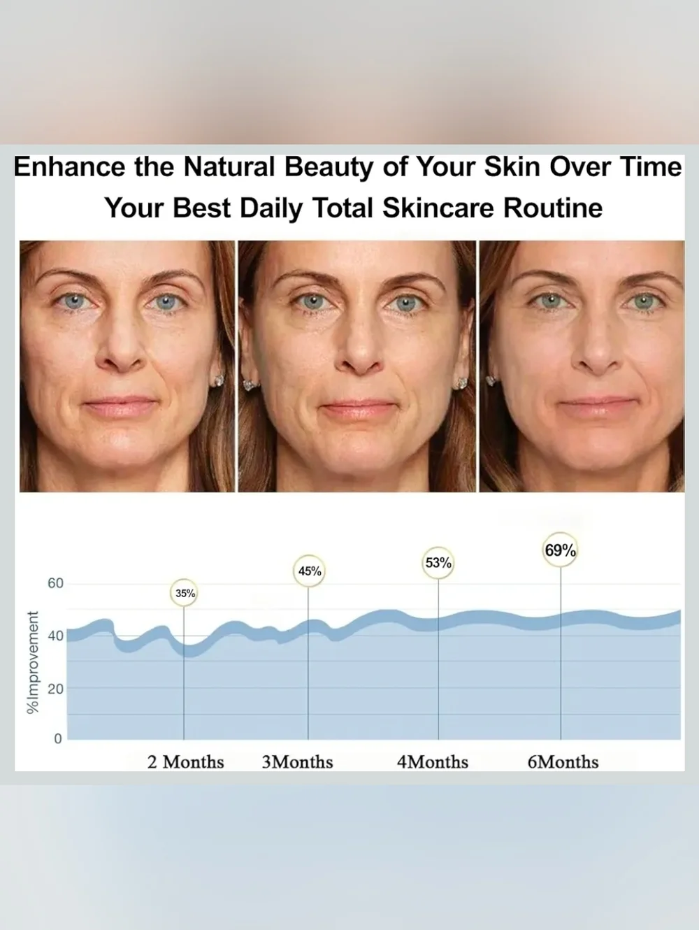 NEW LED Face Mask Skincare Device - Picture 4 of 5